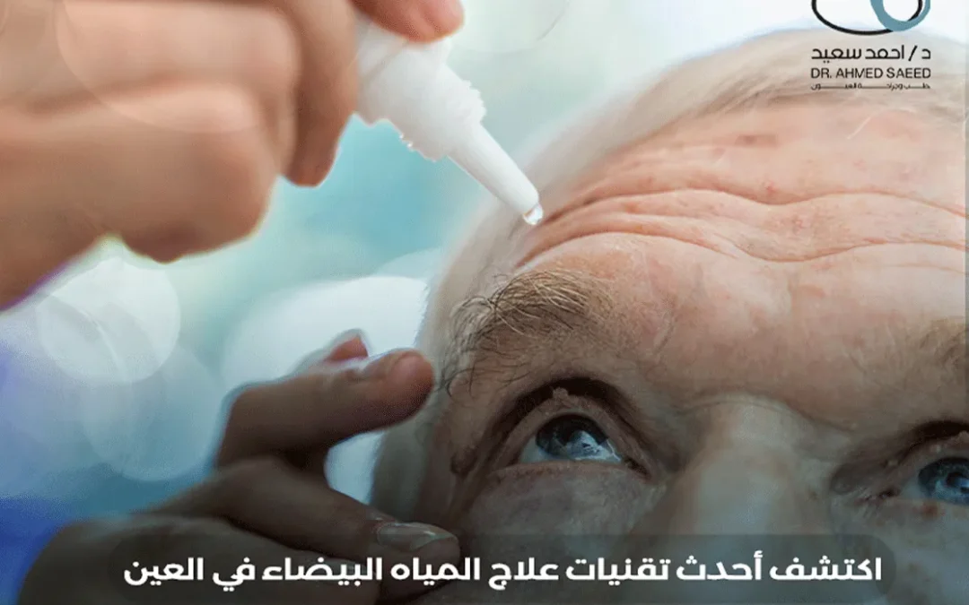 علاج المياه البيضاء في العين