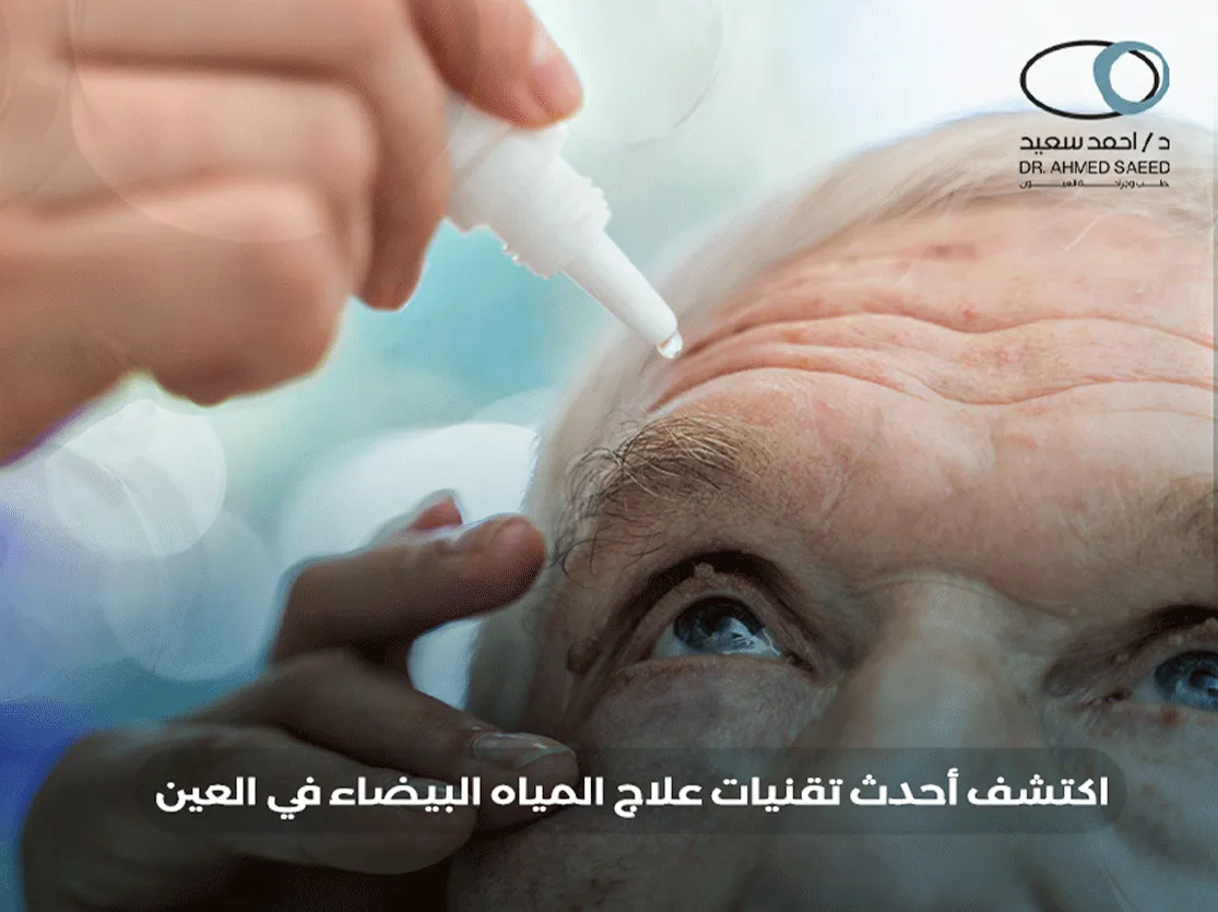 علاج المياه البيضاء في العين
