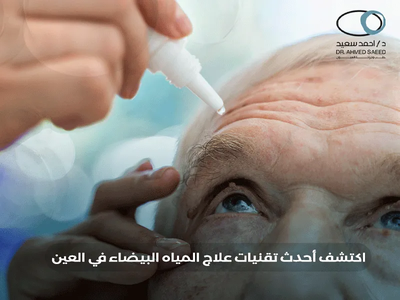 علاج المياه البيضاء في العين