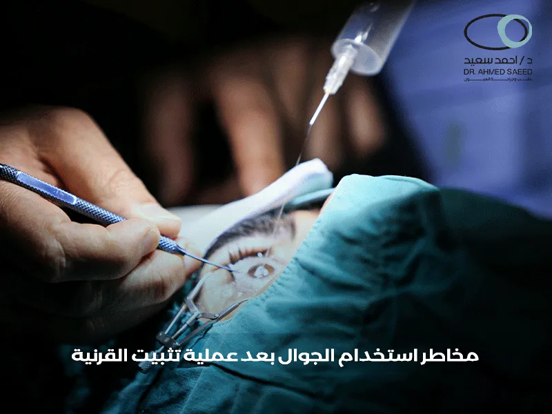 الجوال بعد عملية تثبيت القرنية