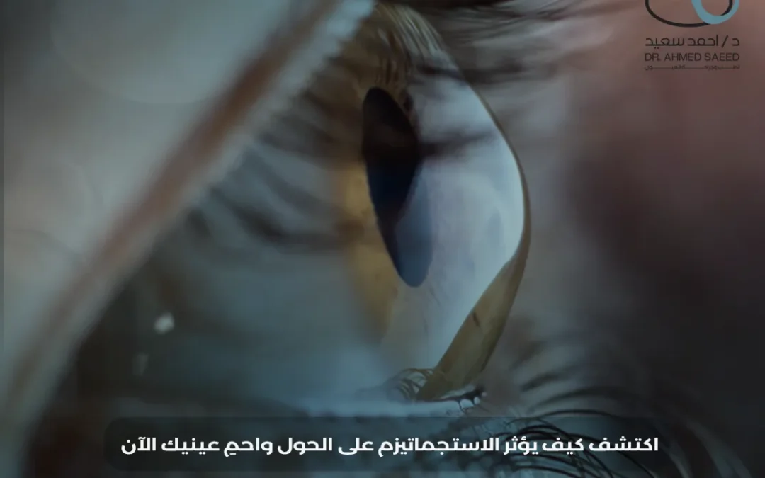 هل الاستجماتيزم يسبب الحول