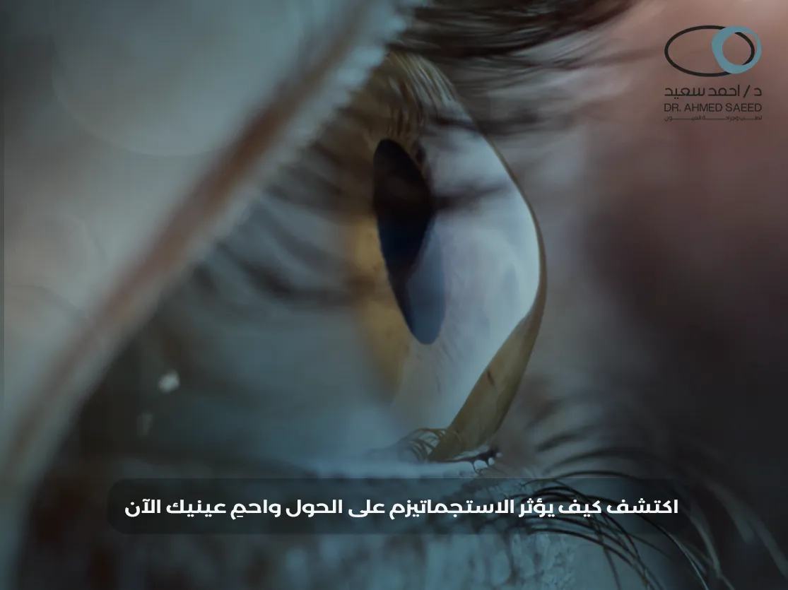 هل الاستجماتيزم يسبب الحول