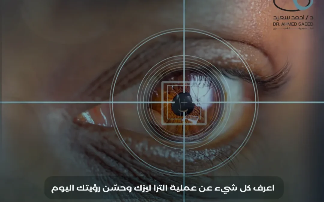 عملية الترا ليزك