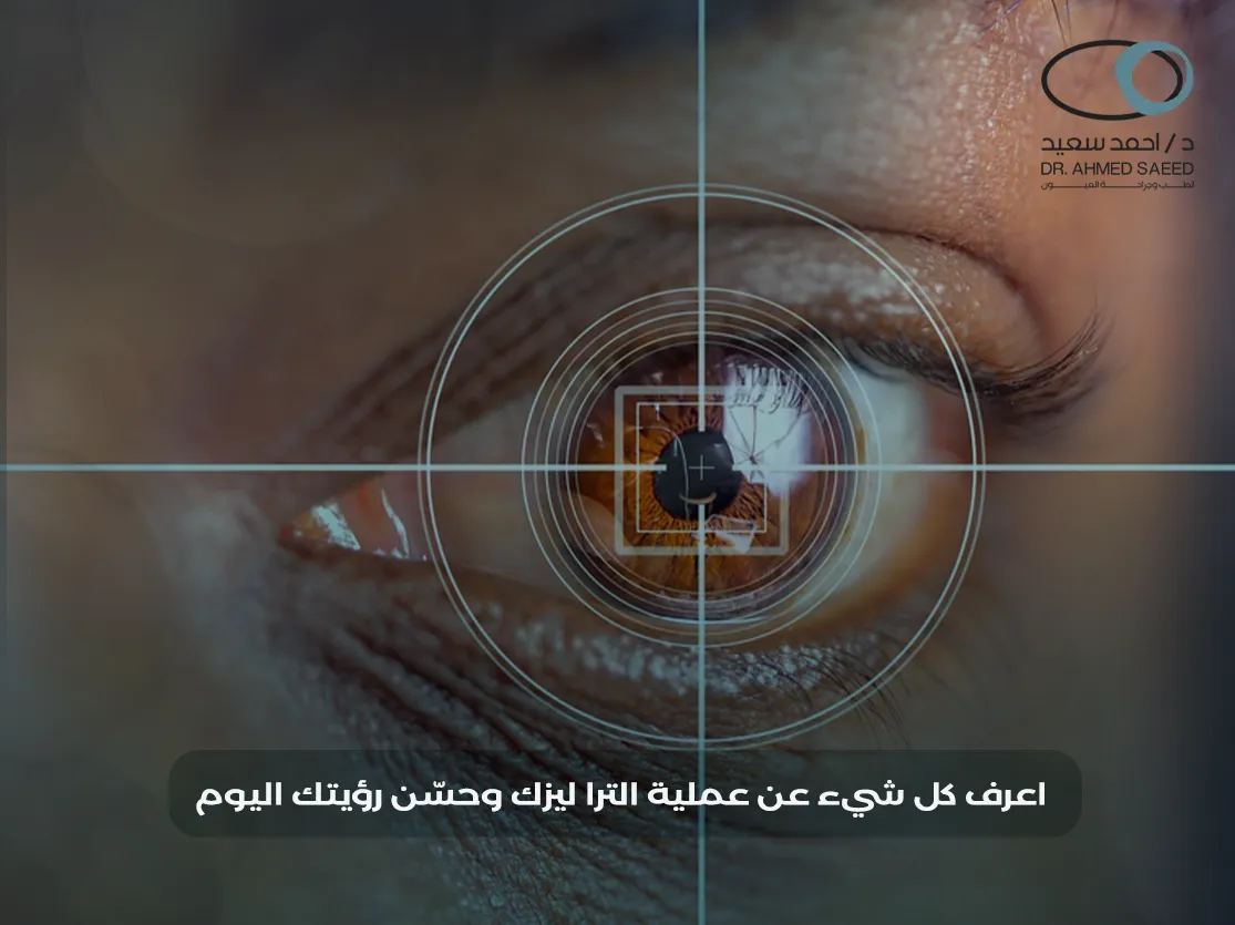 عملية الترا ليزك