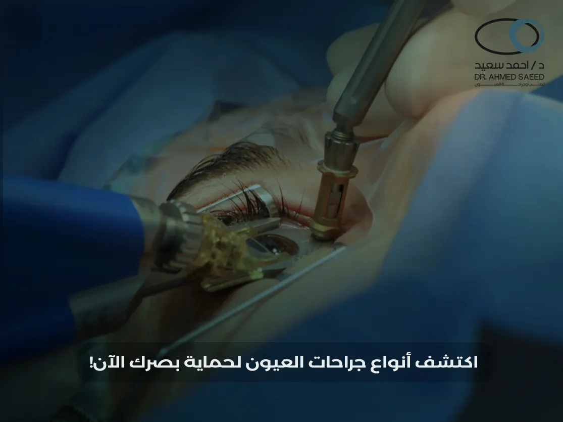 أنواع جراحات العيون