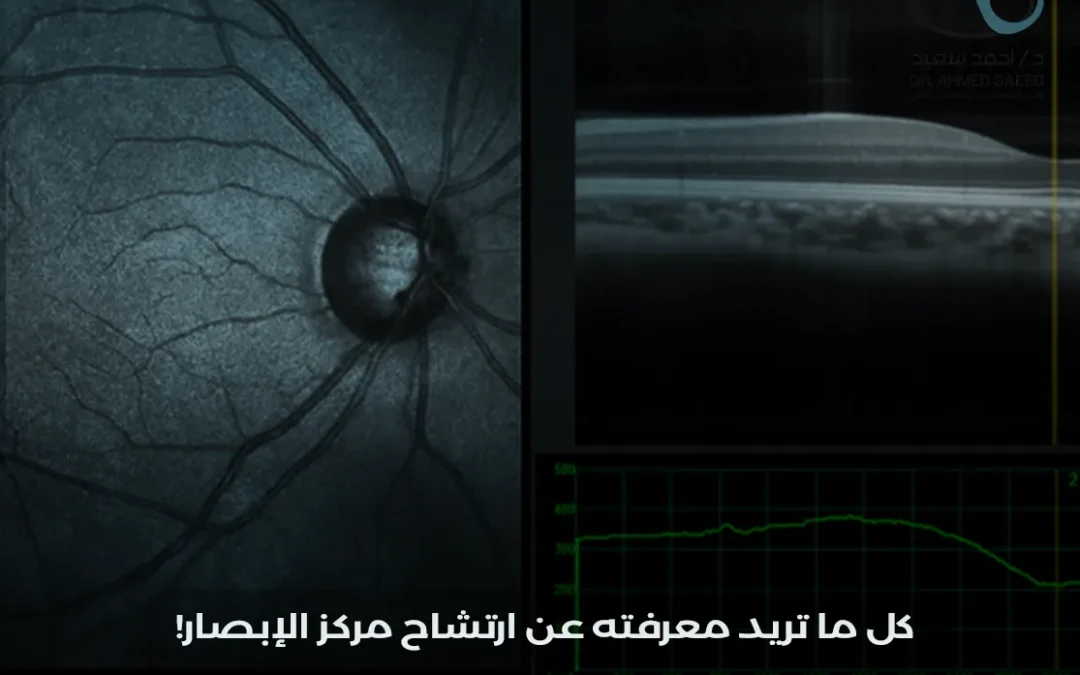 ارتشاح مركز الإبصار