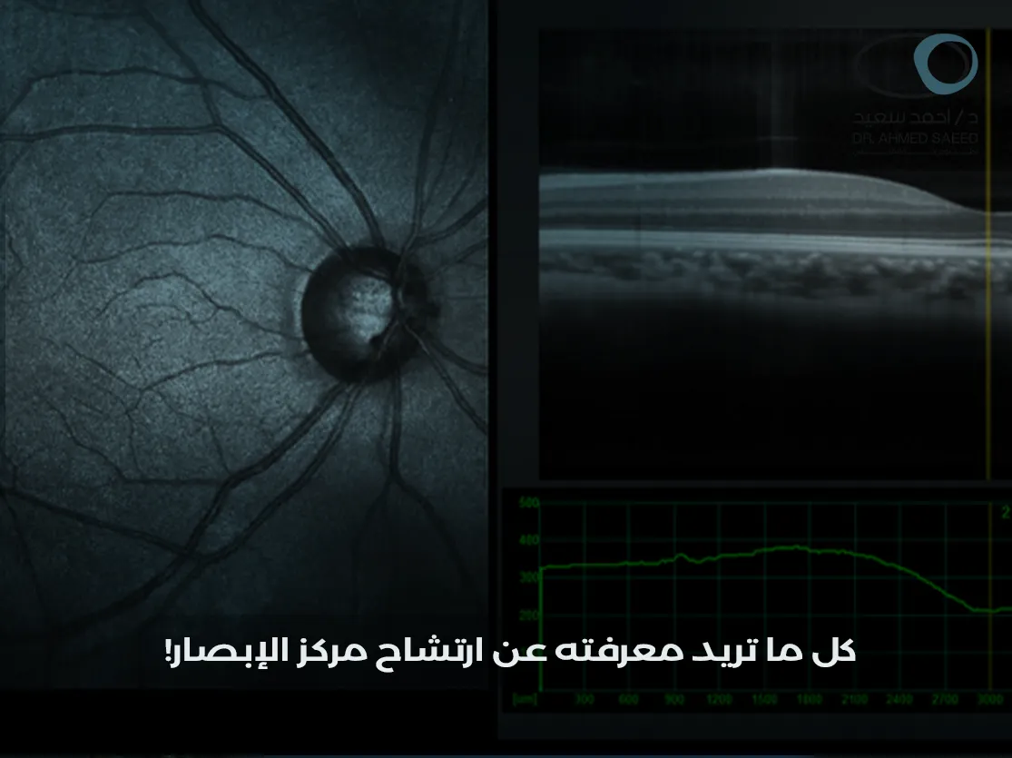 ارتشاح مركز الإبصار