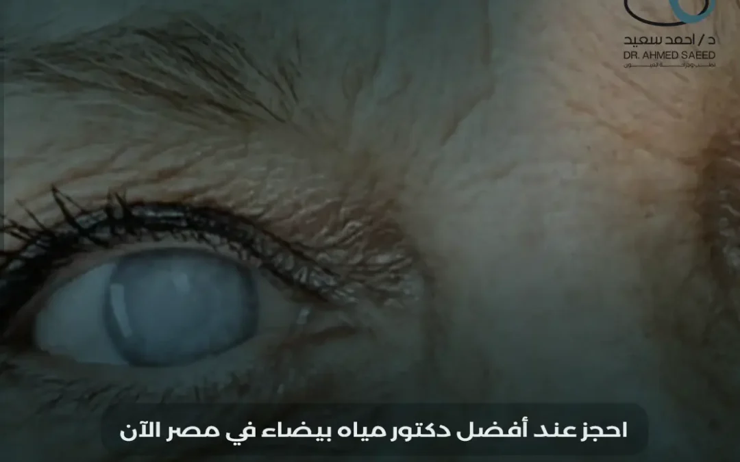 افضل دكتور مياة بيضاء في مصر