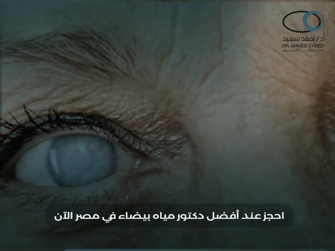 افضل دكتور مياة بيضاء في مصر