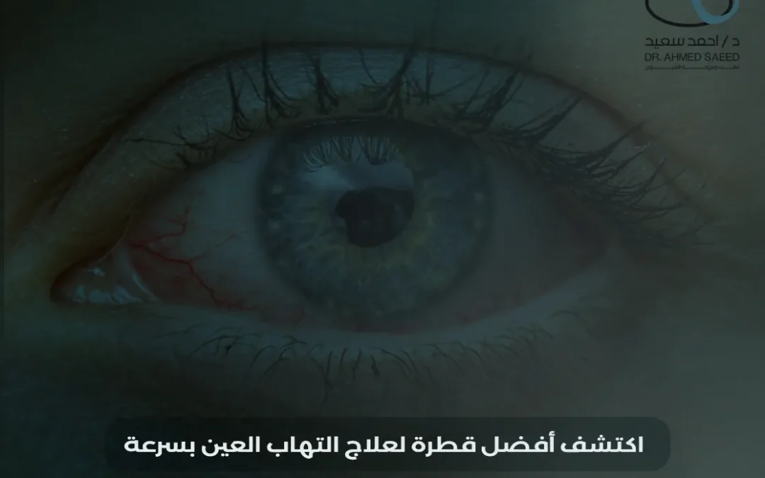 أفضل قطرة لالتهاب العين