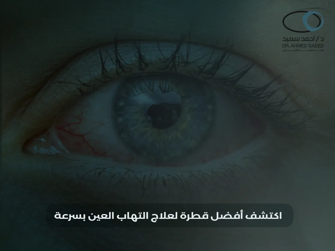 أفضل قطرة لالتهاب العين