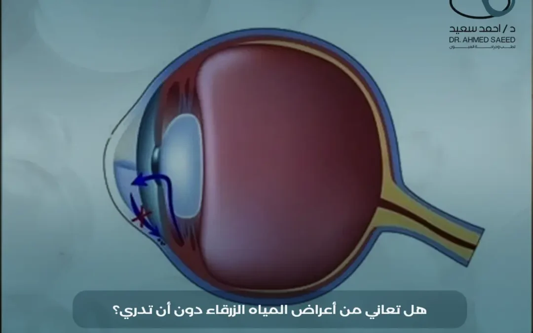 أعراض المياه الزرقاء للكبار