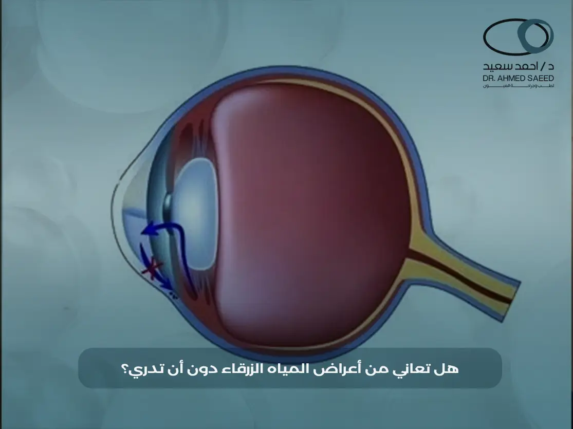 أعراض المياه الزرقاء للكبار أعراض المياه الزرقاء للكبار