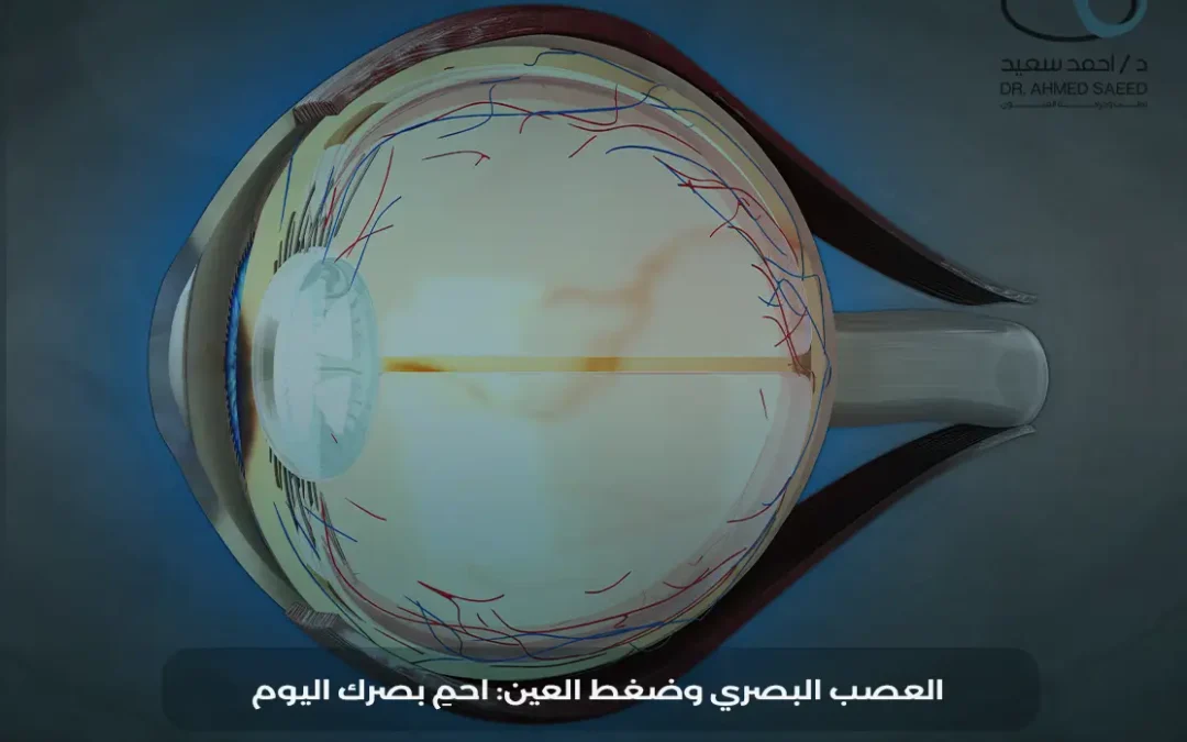 العلاقة بين العصب البصري وضغط العين