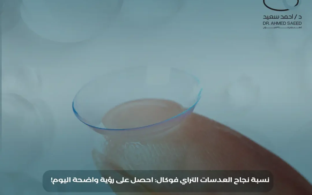 نسبة نجاح زراعة العدسات التراي فوكال