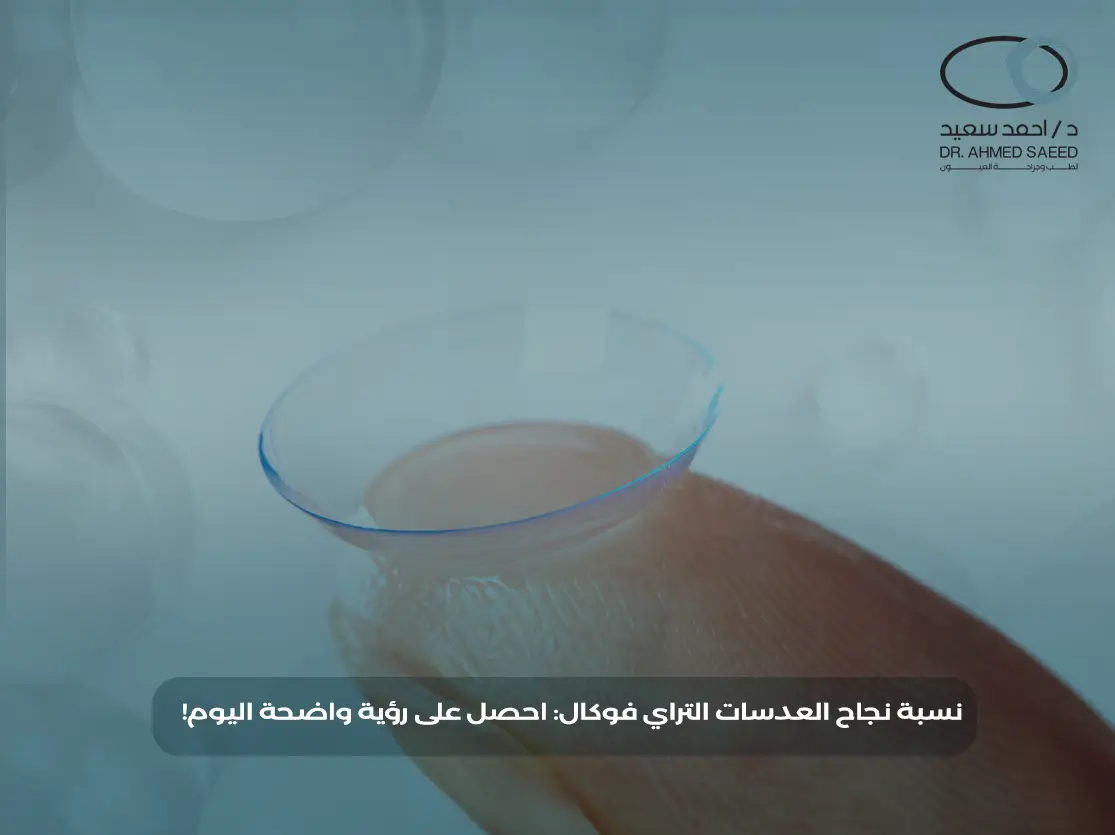 نسبة نجاح زراعة العدسات التراي فوكال