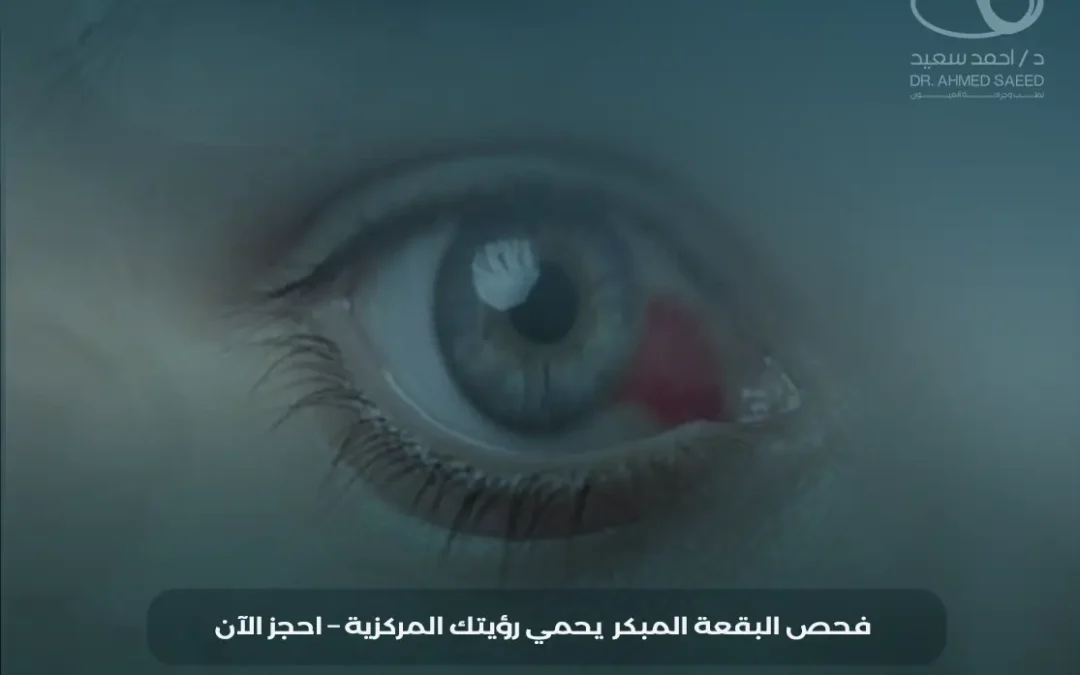 علاج تنكس البقعة العمري في مصر