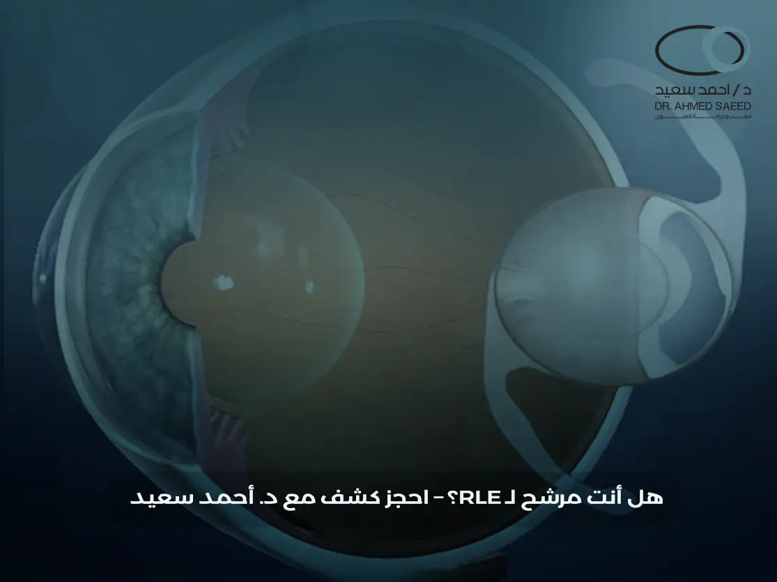 عملية استبدال العدسة الشفافة RLE