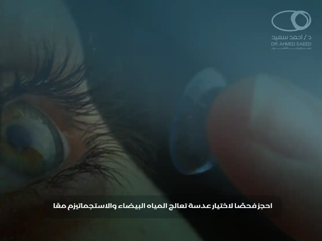 تصحيح الاستجماتيزم مع عملية المياه البيضاء