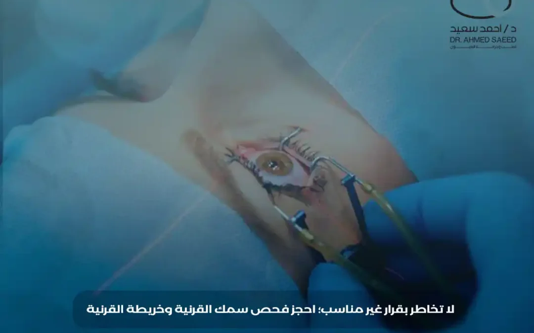 تصحيح النظر للقرنية الرقيقة
