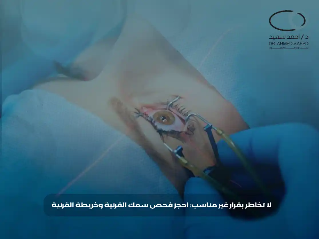 تصحيح النظر للقرنية الرقيقة