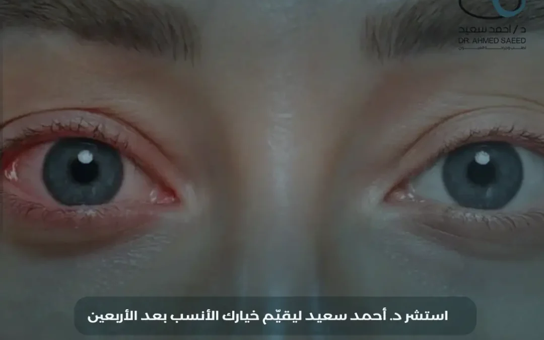 عملية الليزك بعد الأربعين