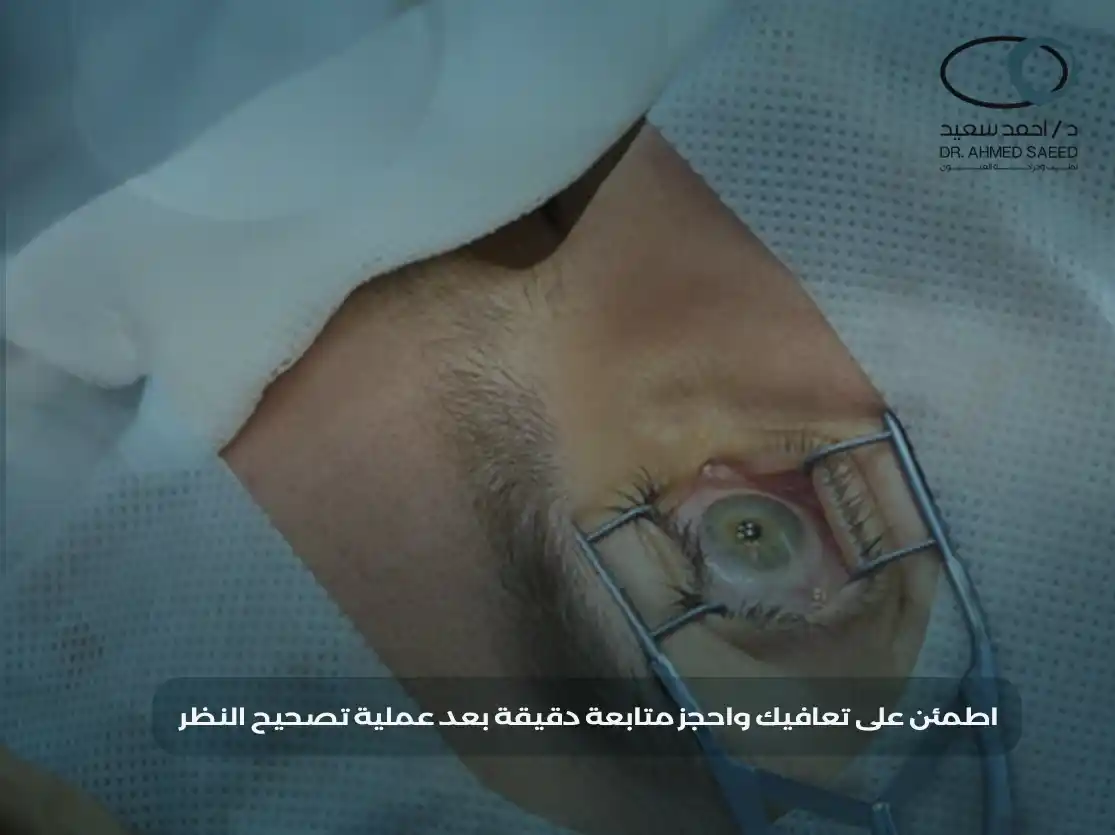 متى تظهر نتيجة عملية تصحيح النظر