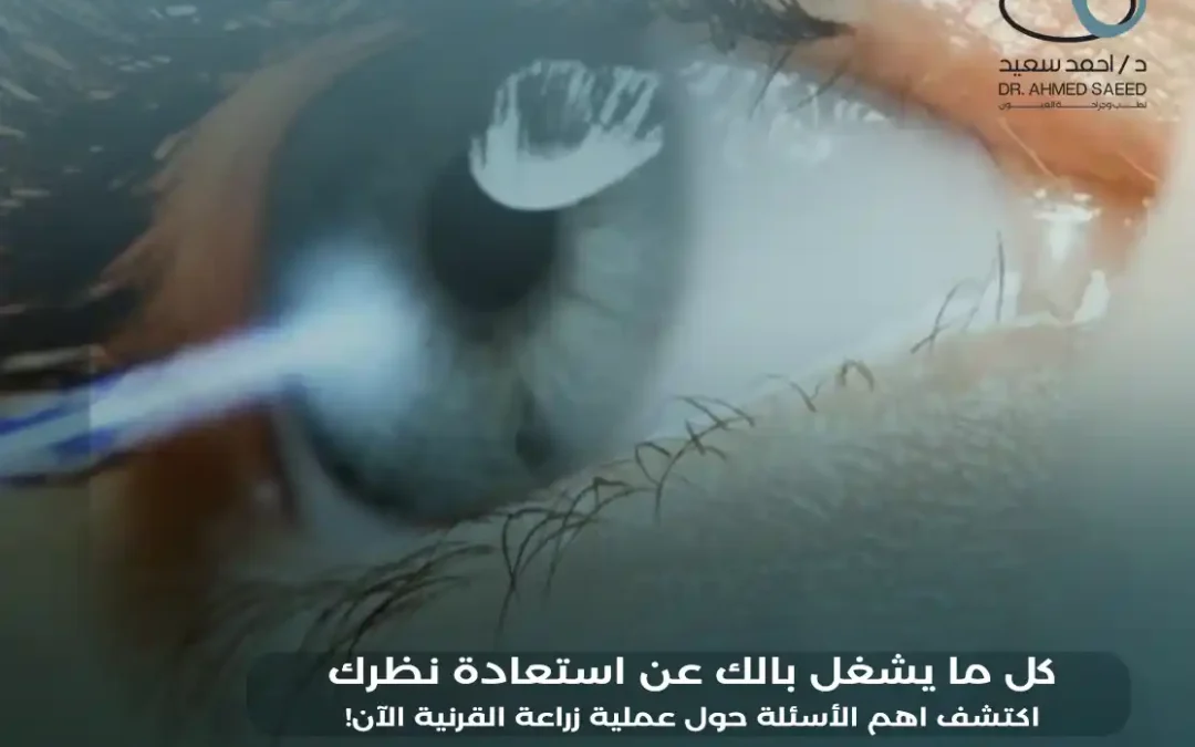 أهم الأسئلة حول عملية زراعة القرنية وإجاباتها الطبية