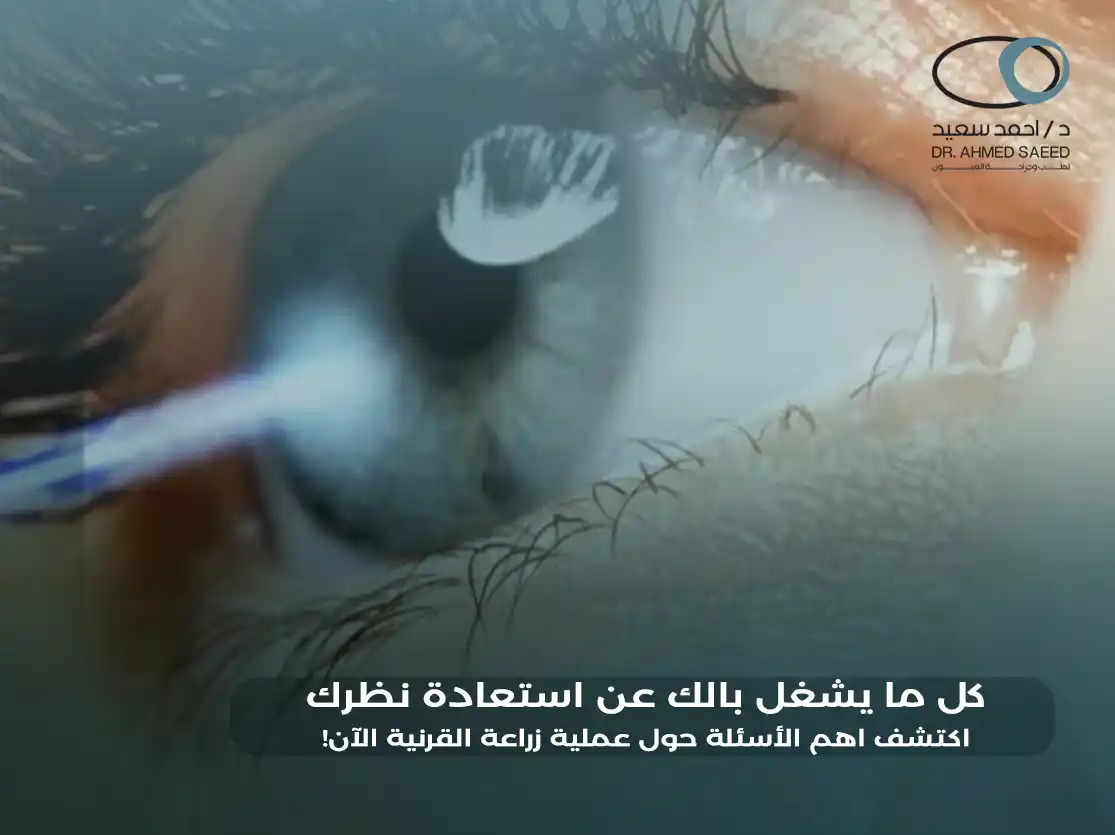 اهم الأسئلة حول عملية زراعة القرنية