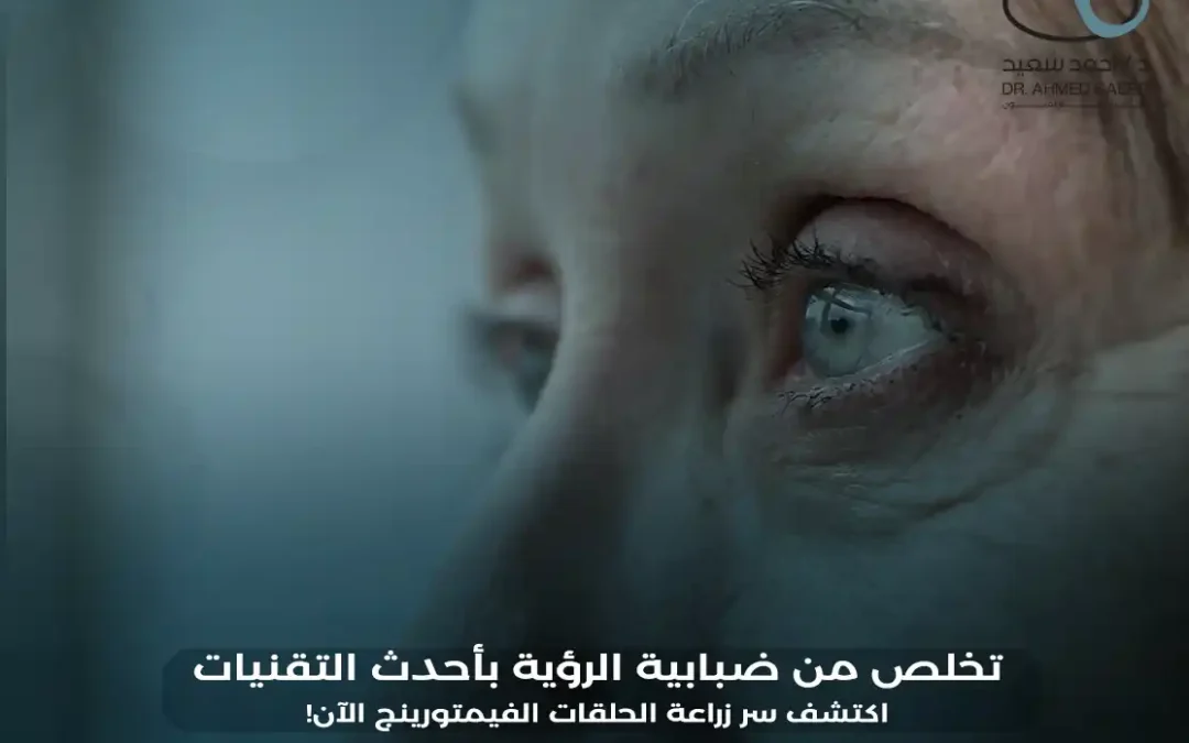 ما يجب معرفته عن عملية زراعة الحلقات الفيمتورينج لعلاج القرنية المخروطية