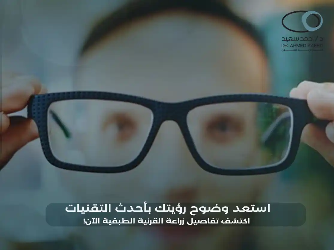 زراعة القرنية الطبقية