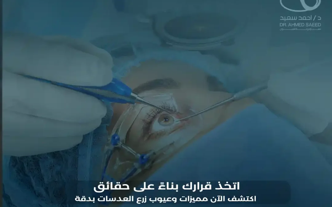 مميزات وعيوب زرع العدسات لتصحيح النظر في عام 2026