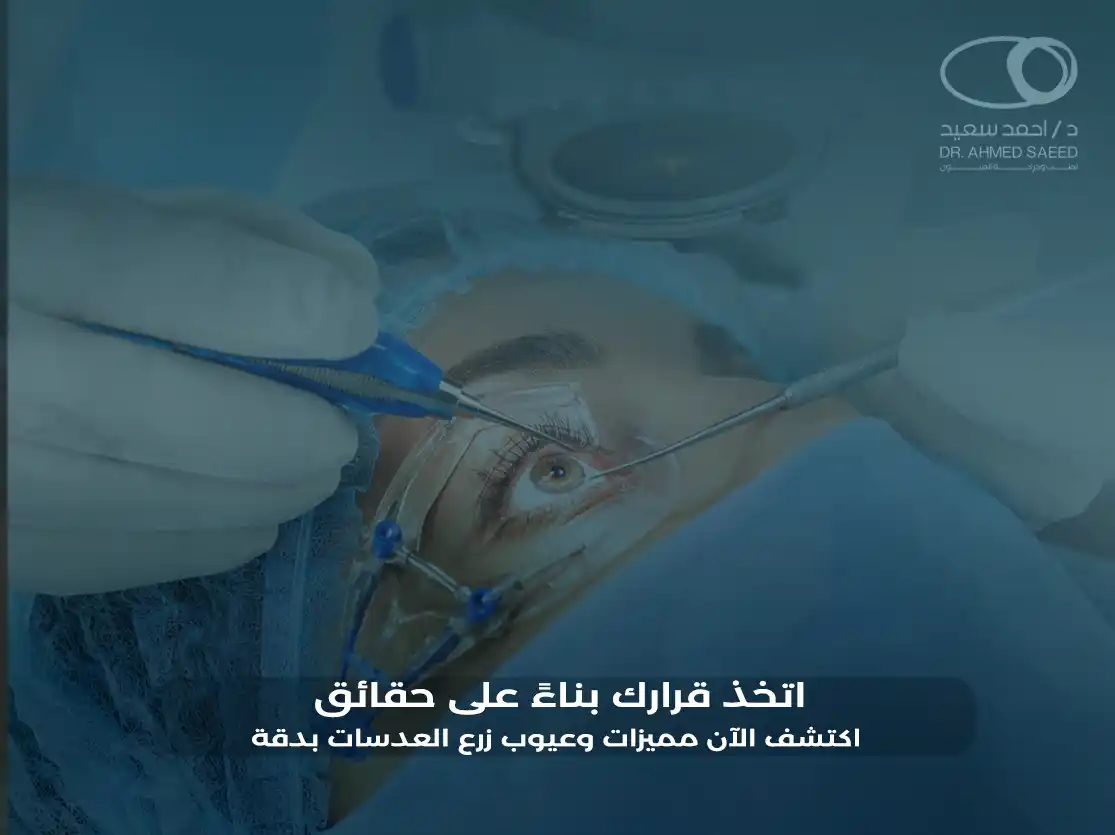 مميزات وعيوب زرع العدسات