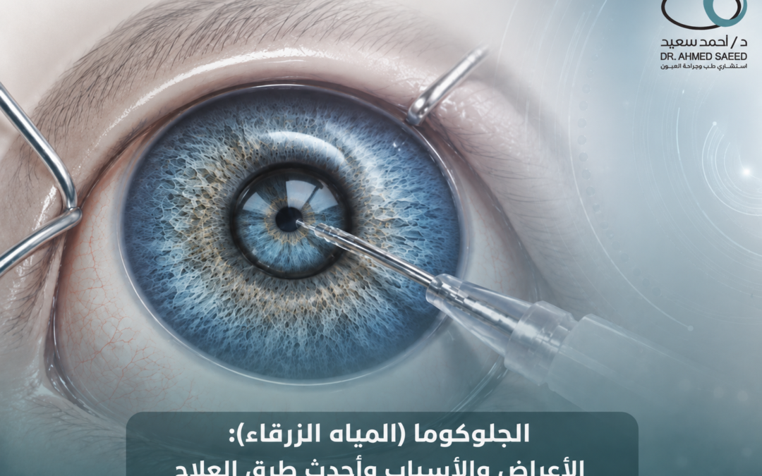 المياه الزرقاء الجلوكوما