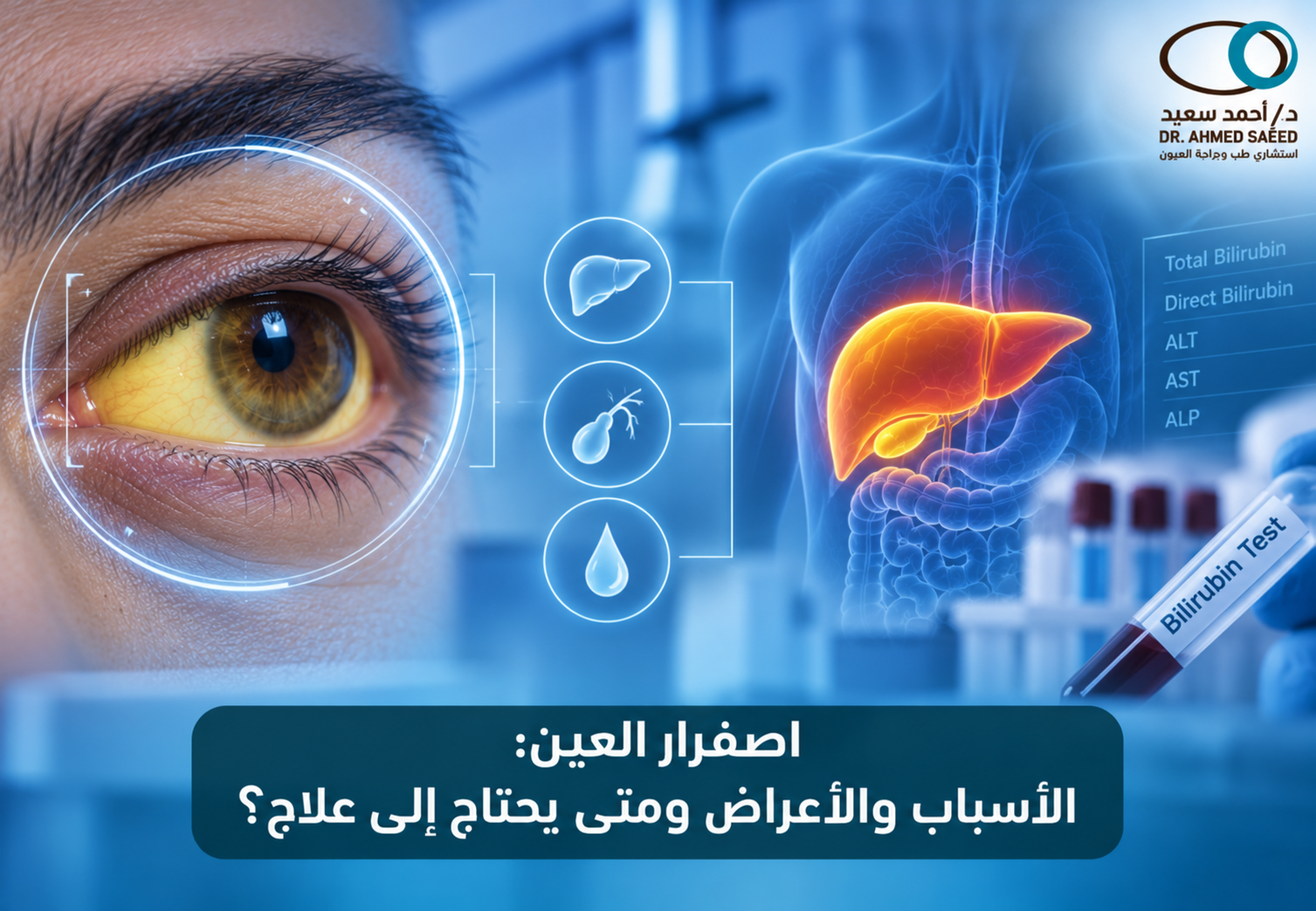 اصفرار العين الأسباب والأعراض ومتى يحتاج إلى علاج؟